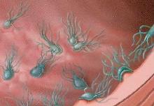 giardia baby symptomen a laposféreg paraziták fontossága